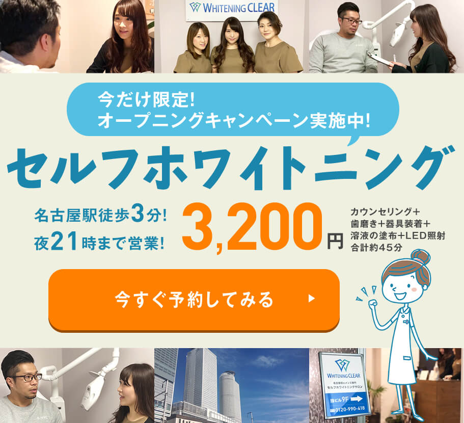 名古屋初!メンズ専門　セルフホワイトニング　名古屋駅徒歩３分　夜21時まで営業　3,200円　カウンセリング+歯磨き＋器具装着+溶液の塗布+LED照射合計約45分 今すぐ予約してみる