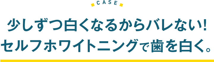 少しずつ白くなるからバレない！セルフホワイトニングで歯を白く。